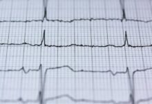 cyber pulse fusion beam identifier